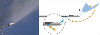 Water-Assisted Lipo Comes of Age