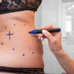 Aesthetic Plastic Surgery Sees 10.2% Growth in Four Years