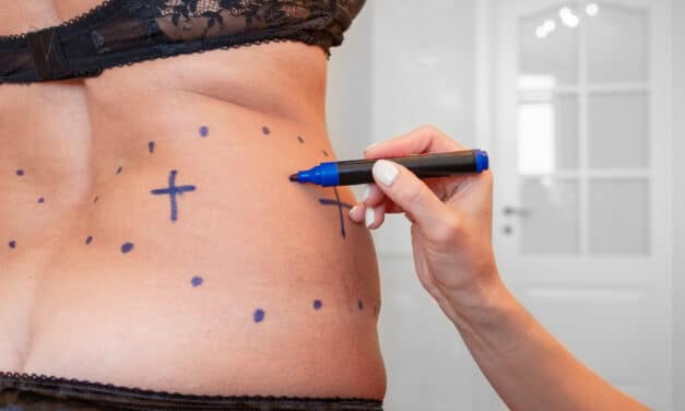 Aesthetic Plastic Surgery Sees 10.2% Growth in Four Years