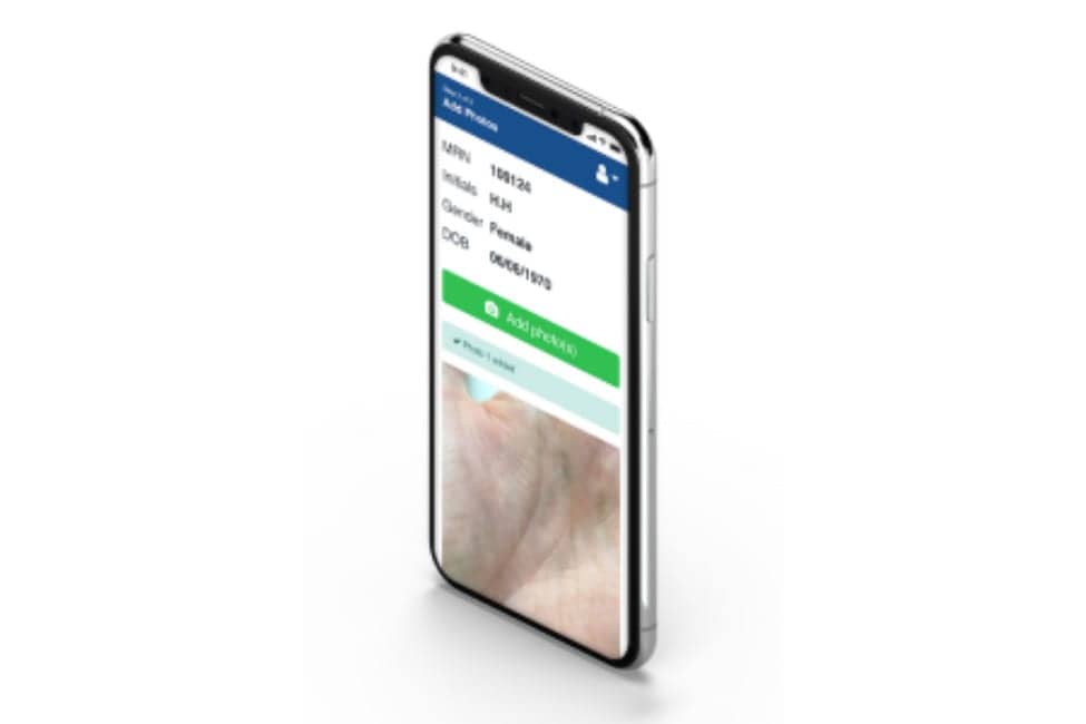New Photo App Aims to Increase Wound Care and Dermatology Consult Support