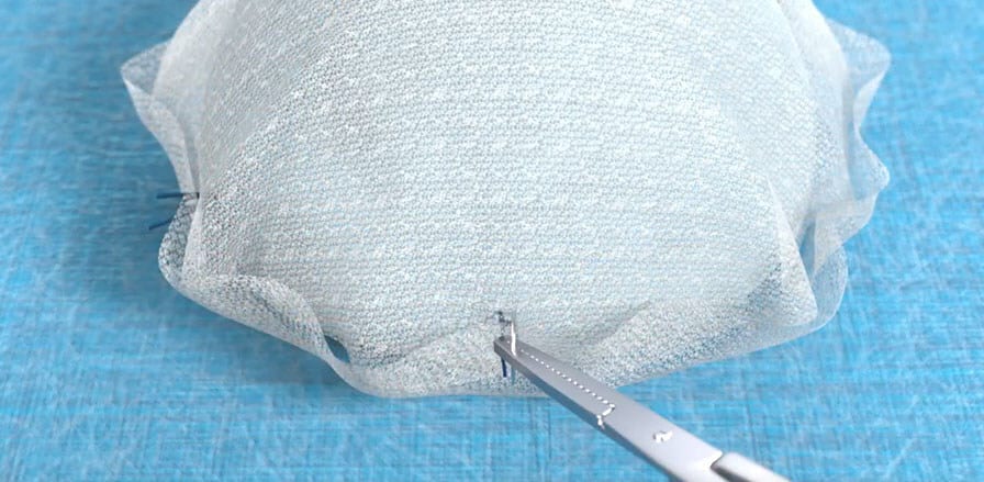 BD Begins Clinical Trial for GalaFLEX LITE Scaffold in Breast Revision Surgery