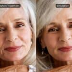 BeautyFix Medspa Launches AI Aesthetics Simulation for Injectables
