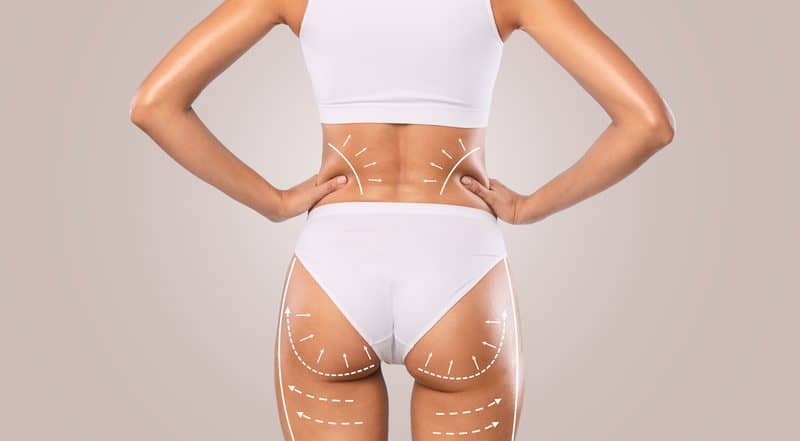 Influencing the Industry: Doctor Banned from Performing ‘Brazilian Butt Lift’ Surgeries After Deaths
