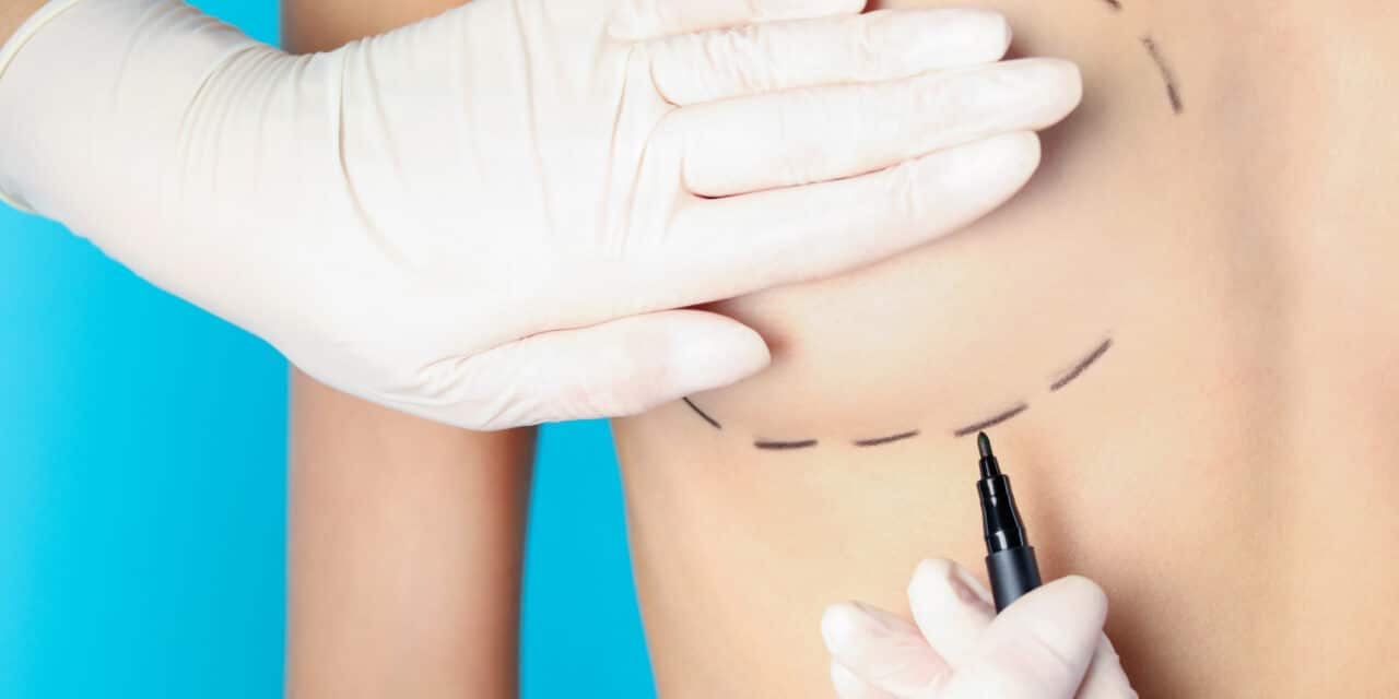 Establishment Labs Launches Preservé for Aesthetic Breast Augmentation in Brazil