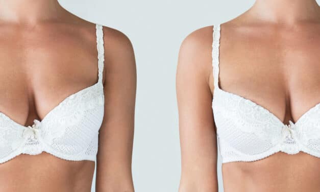 Neural Network Enables Objective Assessment of Breast Symmetry