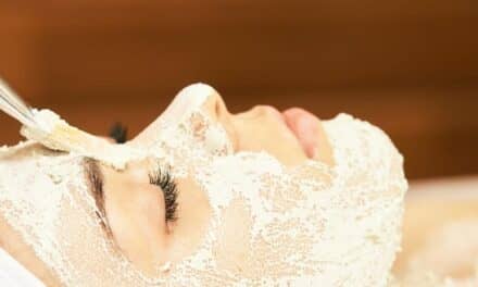 Top 5 Questions To Ask If You Want A Chemical Peel