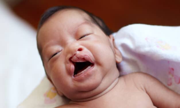 Racial and Ethnic Disparities in Cleft Lip Surgery for Children