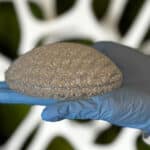 CollPlant, Stratasys Explore 3D-Printed Breast Implants