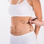 Americans Favor Cosmetic Procedures in 2023 Despite Economic Hurdles