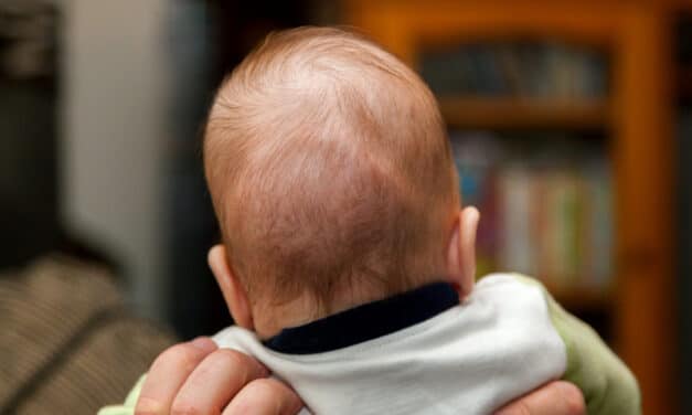 Racial, Socioeconomic Factors Delay Craniosynostosis Diagnosis