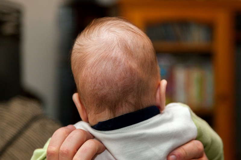 Racial, Socioeconomic Factors Delay Craniosynostosis Diagnosis