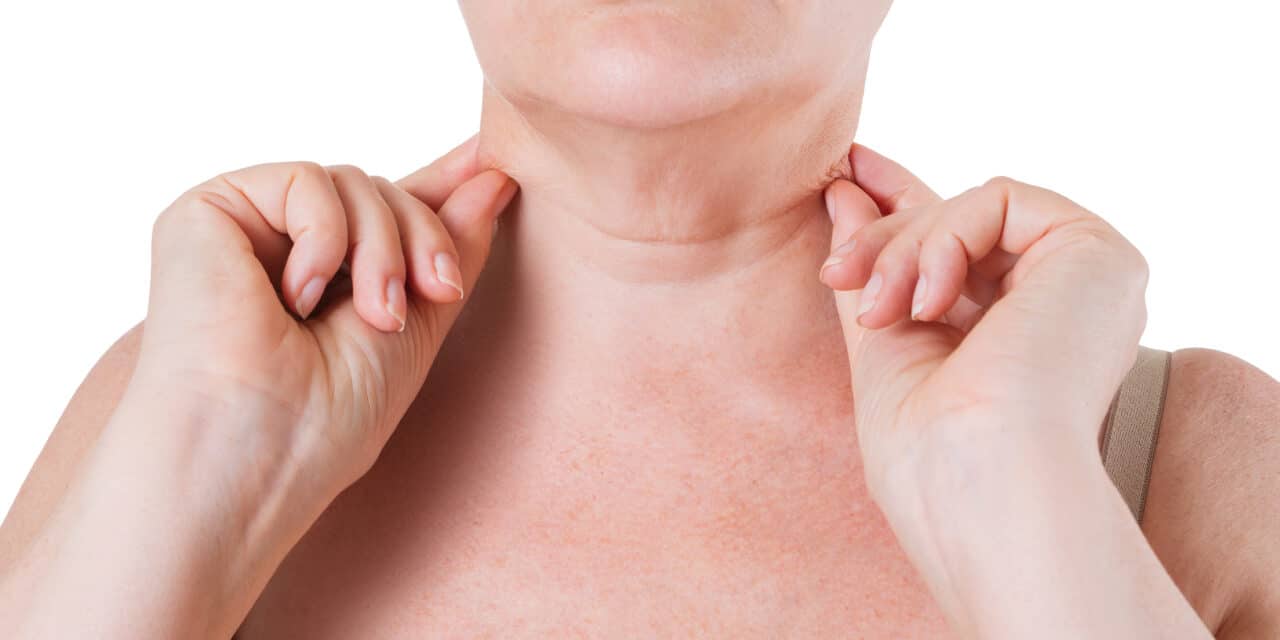 Neck Lifts and Setting Realistic Patient Expectations
