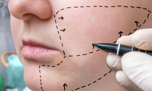 Plastic Surgery Leads to Happier Endings for Film Characters