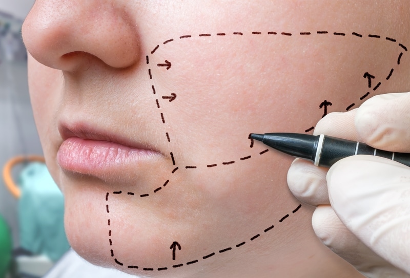 Plastic Surgery Leads to Happier Endings for Film Characters