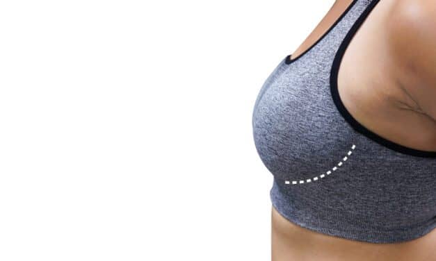 Sientra Launches Viality Fat Transfer System 
