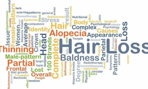 Low-Level Laser Therapy for Hereditary Hair Loss