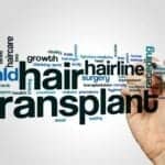 What Can You Do After a Hair Transplant?