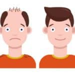 ISHRS Hosts ‘World Hair Transplant Repair Day,’ Nov 11