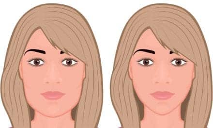 Rise Of The Golden Jawline – How Jawline Filler Became The Must-Have Aesthetic Treatment