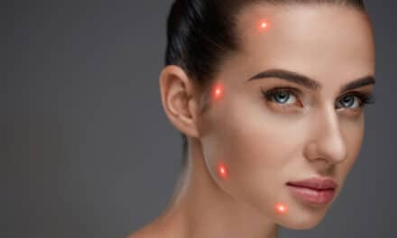 The Synergy of Light and Lotion: How Skincare is Transforming Laser Aesthetics