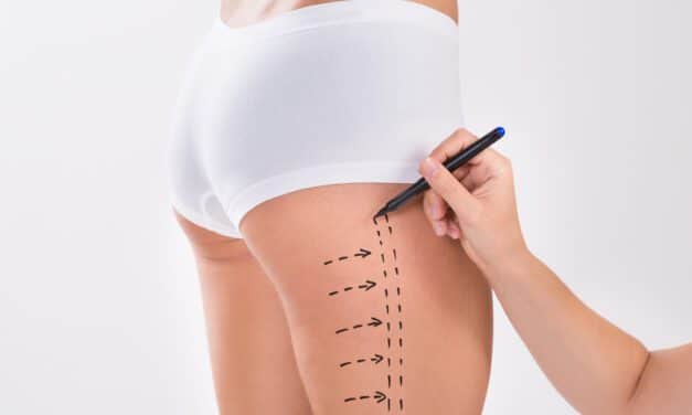 Plastic Surgeon Offers Liposuction Training Course