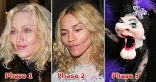 How Much Plastic Surgery Can You Buy for $200K?