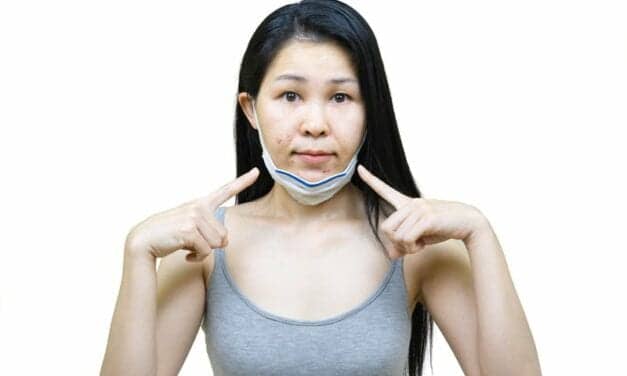 Your ‘Maskne’ Might Not Be Acne at All