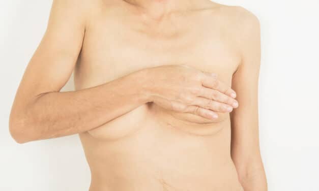 <strong>Natural Tissue Breast Reconstruction for Thin People</strong>
