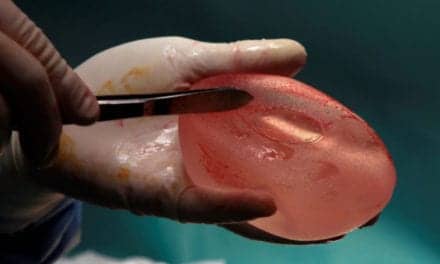 Women with Defective French Breast Implants May Claim Damages Only in France: EU Court Adviser