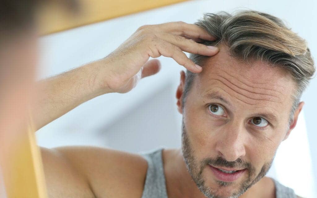 Evolution of Hair Restoration: From Stigma to Natural Results