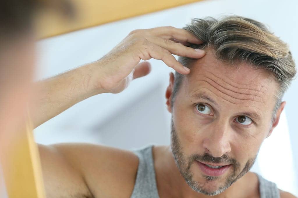 Evolution of Hair Restoration: From Stigma to Natural Results