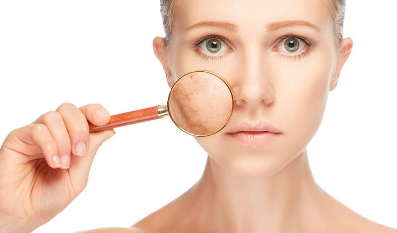 Cynosure Upgrades PicoSure System with PicoSure Pro Device